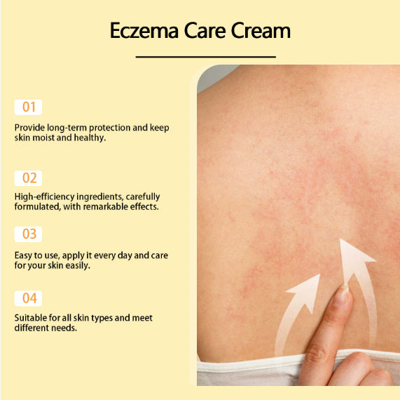 Eczema Care Cream